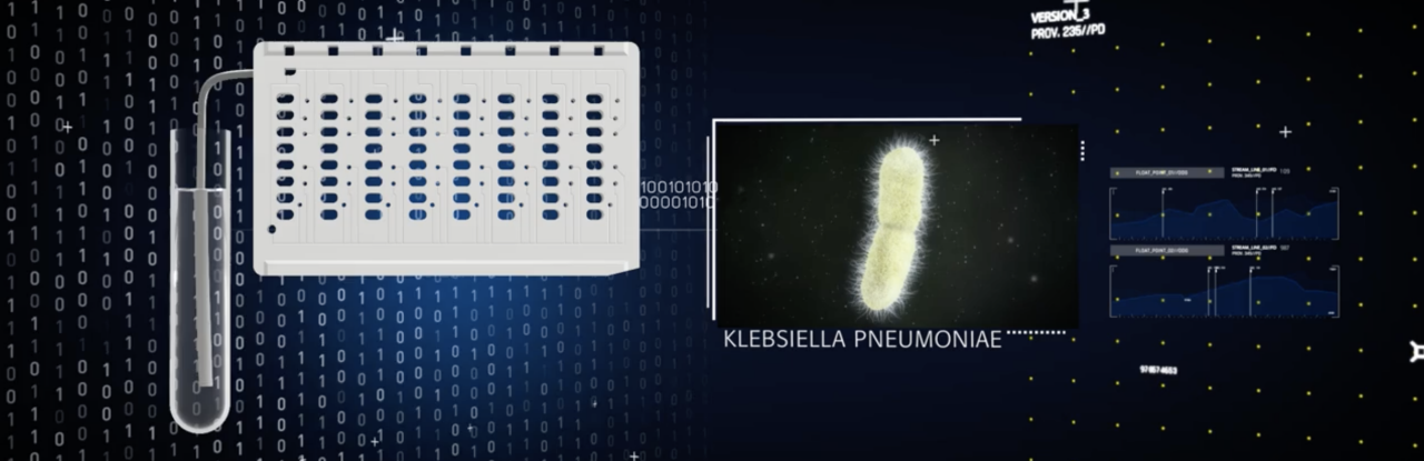 Immersive video UTI management